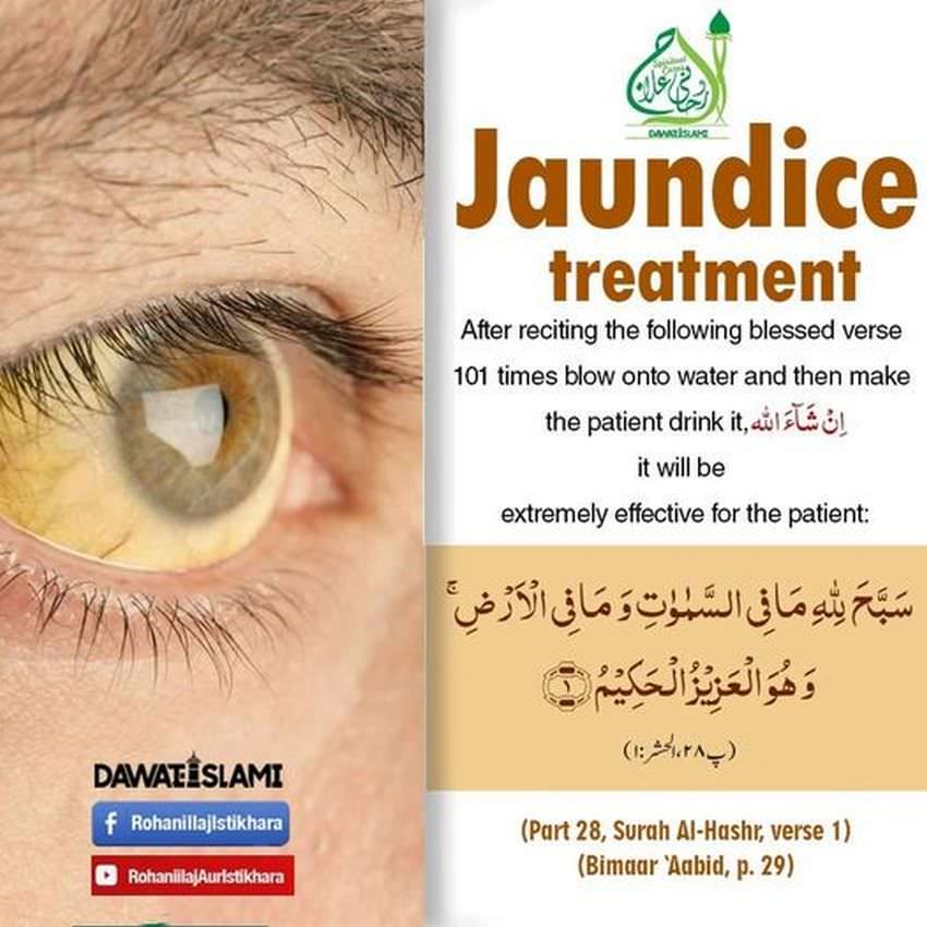 Jaundice Treatment