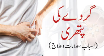 گردے کی پتھری (اسباب، علامات و علاج)